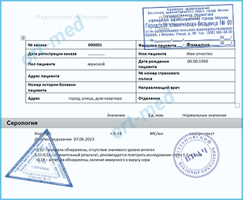 Купить тест на антитела к вирусу кори Купить справку тест на антитела к вирусу кори в Москве официально